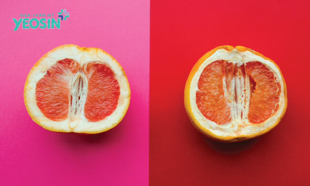 Trẻ hóa vùng kín cho phụ nữ trên 30 tuổi