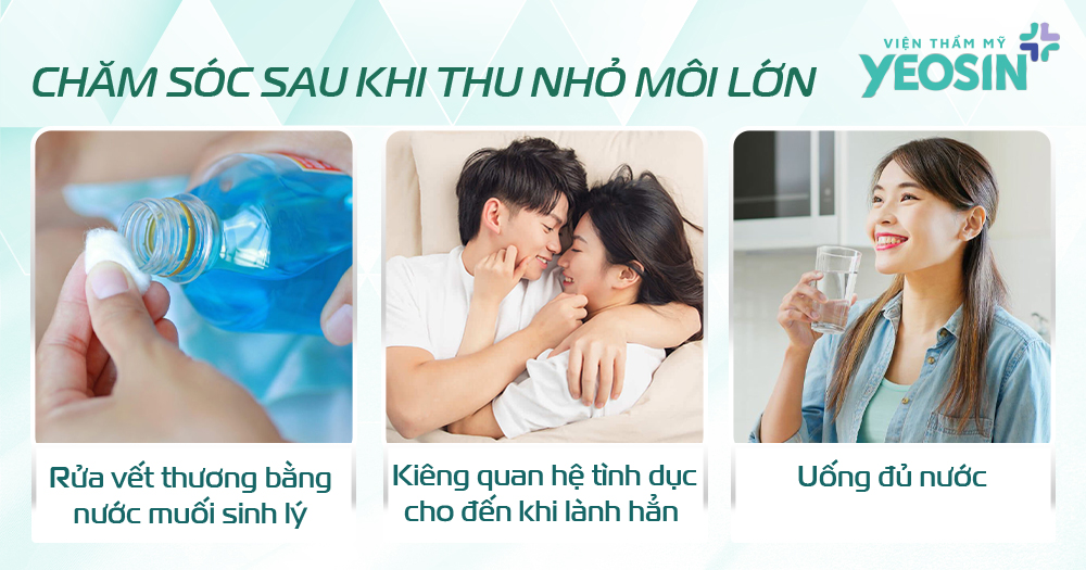Những lưu ý sau khi thu nhỏ môi lớn bạn cần biết