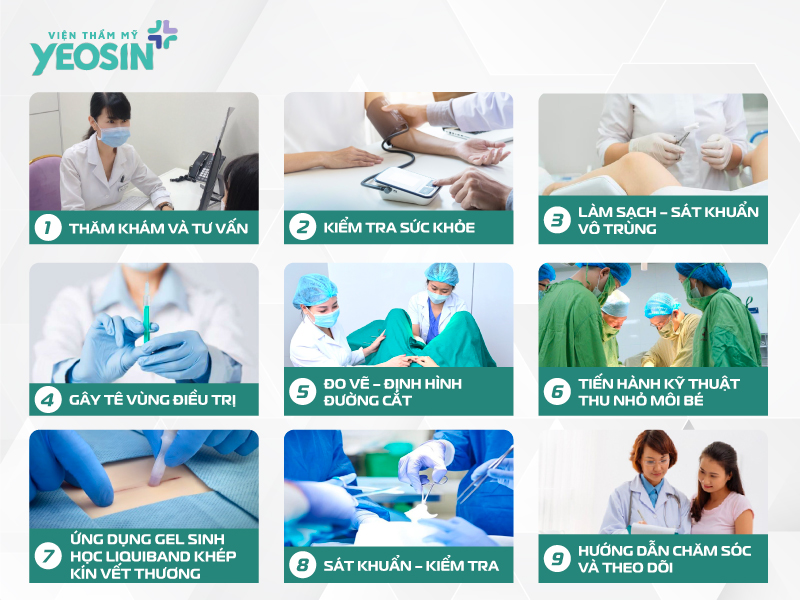 Quy trình thu nhỏ cô bé tại Viện Thẩm Mỹ Yeosin.