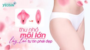 Viện Thẩm Mỹ Yeosin - Địa chỉ cắt môi cô bé uy tín tại Tphcm.