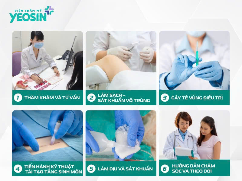 Quy trình thực hiện tái tạo tầng sinh môn sau sinh tại Viện Thẩm Mỹ Yeosin