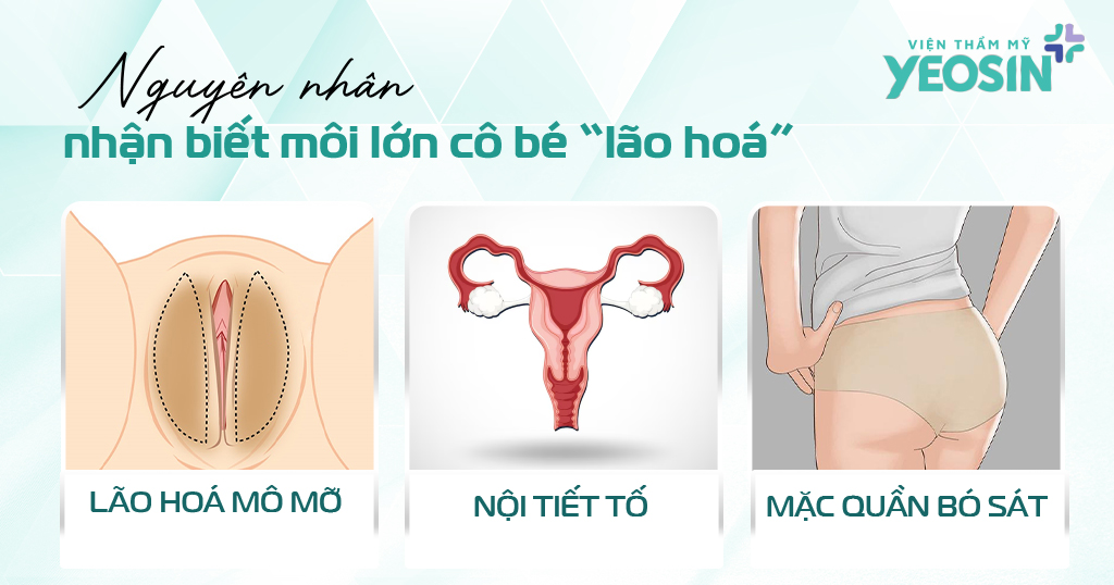 Nguyên nhân khiến môi lớn bị lão hóa