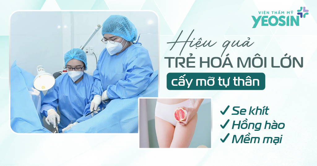 Hiệu quả nhận được sau khi làm đầy môi lớn bằng cấy mỡ tự thân.