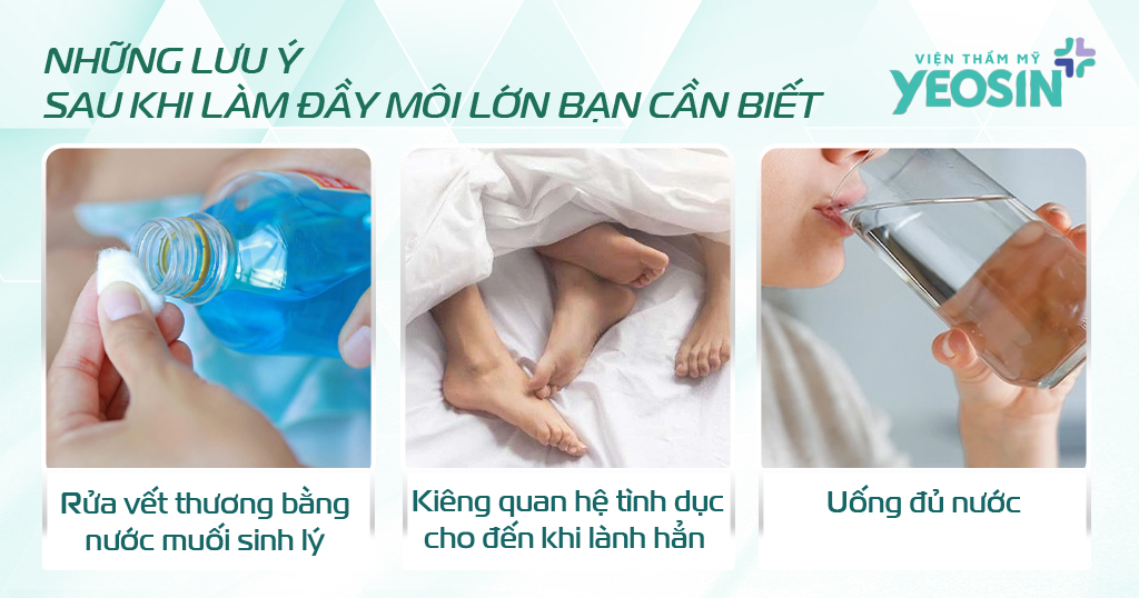 Những lưu ý sau khi làm đầy môi lớn bạn cần biết