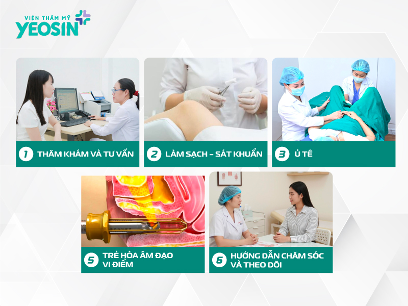 Quy trình trẻ hóa âm đạo bằng công nghệ vi điểm tại Viện Thẩm Mỹ Yeosin