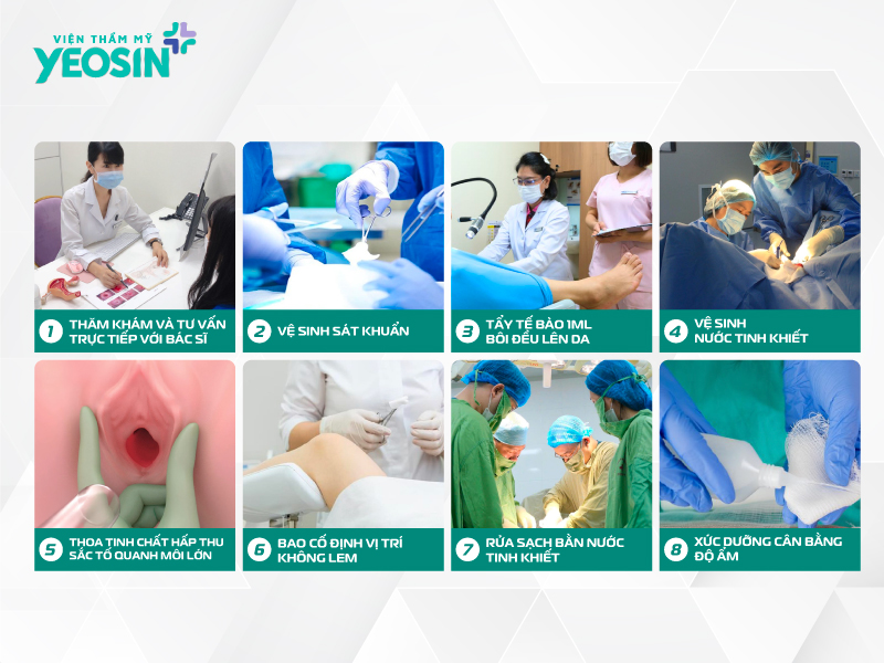 Quy trình làm hồng bikini tại Viện Thẩm Mỹ Yeosin