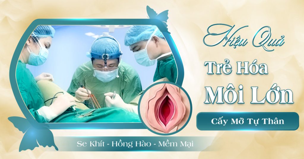 làm đầy môi lớn
