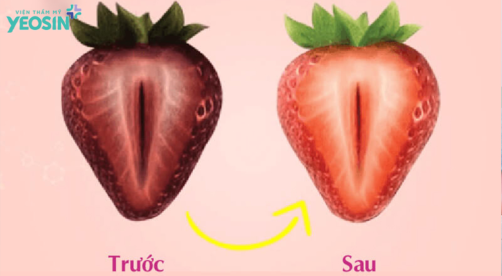 Ưu điểm vượt trội của công nghệ làm hồng cô bé Light Pink chiếc tách tế bào tầng sâu