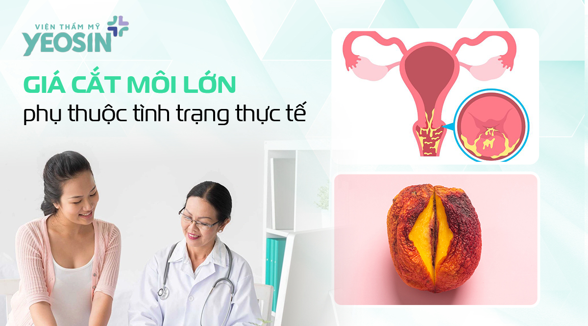 Giá cắt môi lớn vùng kín sẽ phụ thuộc vào tình trạng vùng kín thực tế