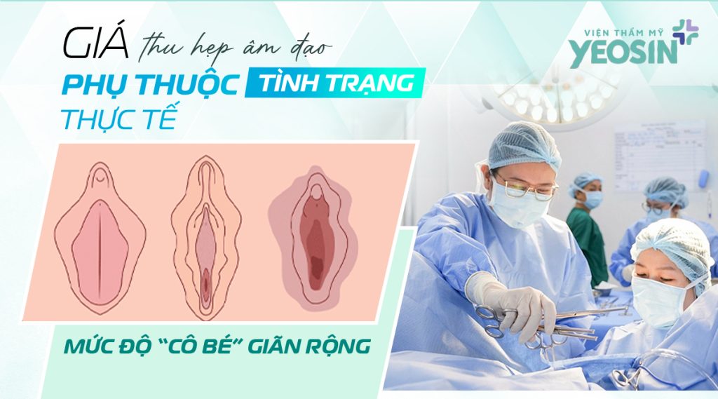Giá thu hẹp âm đạo sẽ phụ thuộc vào tình trạng vùng kín thực tế