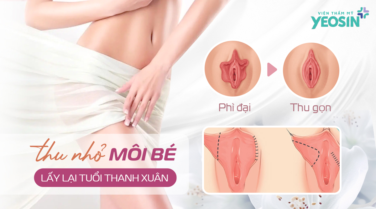 Cắt môi bé giá bao nhiêu - Địa chỉ cắt môi cô bé uy tín tại Tphcm