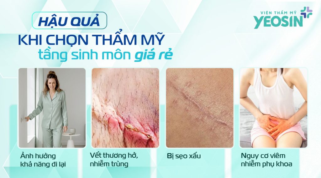 Cảnh báo khi chọn thẩm mỹ tầng sinh môn giá rẻ