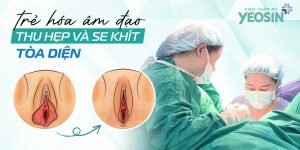 Chi phí trẻ hóa âm đạo giá bao nhiêu - Bảng giá trẻ hóa cô bé