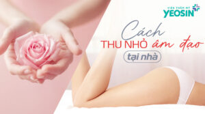 cách thu nhỏ âm đạo tại nhà