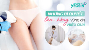 Bí quyết làm hồng cô bé an toàn và hiệu quả nhất hiện nay
