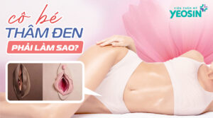 Cô bé bị thâm đen phải làm sao?