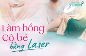 Giải đáp 7 thắc mắc về làm hồng cô bé bằng laser