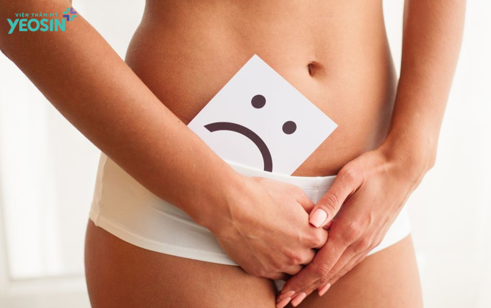 Nguyên nhân cô bé bị thâm đen là gì?