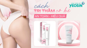 cách trị thâm cô bé an toàn và hiệu quả nhất hiện nay