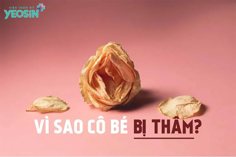 Nguyên nhân chính khiến cô bé bị thâm sạm