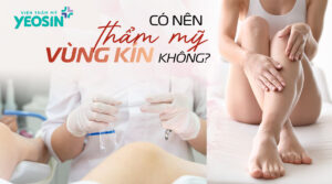 co nen tham my vung kin khong